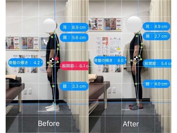 ナオル整体 人形町店(NAORU整体)/姿勢矯正/デスクワーク/肩こり