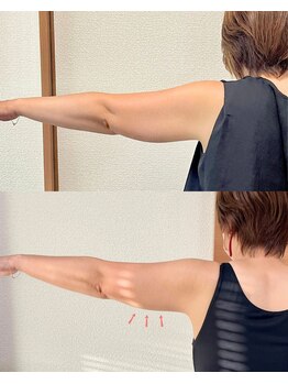 えんじゅ/二の腕