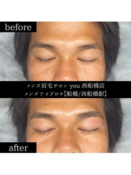 ユー 西船橋店(you)/ビフォーアフター写真