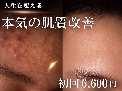アルト(ALTO)の写真