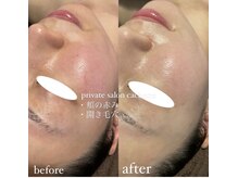 カシェット(cachette)/