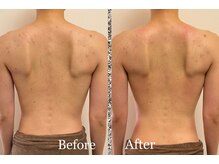 プリマベラ 大阪梅田(primabella)/くびれGET！！