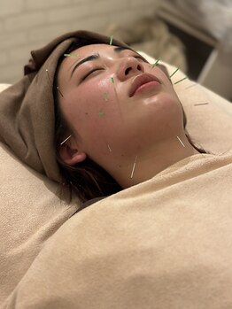 ファーストフォース鍼灸整体院 分倍河原店(1st. force鍼灸整体院)の写真/親子/カップル/友人での同時施術◎お悩みに沿った施術★1人では不安な方もペアでお得にご来店頂けます♪