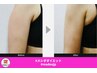 【最上級レベル痩身】二の腕メシダ脂肪分解BOOST＋3機種使用脂肪ブレイク導入