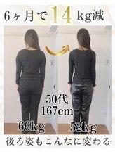 アシュネ(Axiune)/【耳つぼ】50代・6ヶ月・-1４kｇ