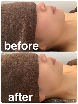 ギンザアール(GINZA R.)/