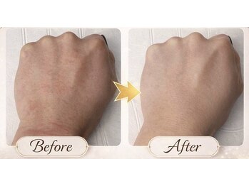 ターミナルジム アンド ビューティーサロン(TERMINAL GYM&BEAUTY SALON)/新メニュー手荒れ改善ケア