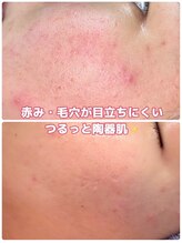 アミクール エステティックサロン(amicoeur)/