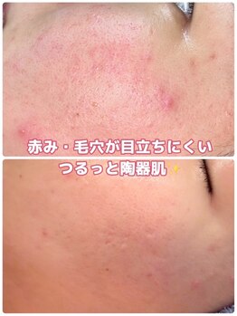 アミクール エステティックサロン(amicoeur)/