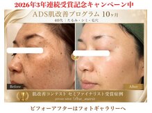 デアマリスの雰囲気（コンテスト受賞信頼と実績！素肌美を求めるお客様多数ご来店）