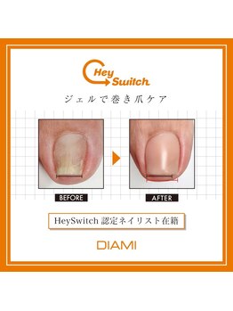 アリューム 北山の写真/爪のお悩みを何でもご相談ください。ケアネイリスト在籍/ケアネイリスト認定校　/ジェルネイル/地爪育成