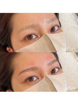 ダリ(Dali)/ハリウッドブロウリフト