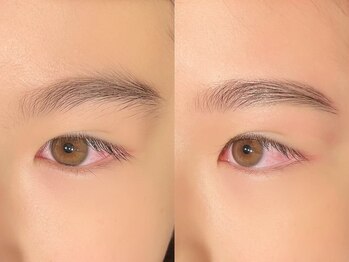 カラーリゾート Ai 葛西店/WAX脱毛