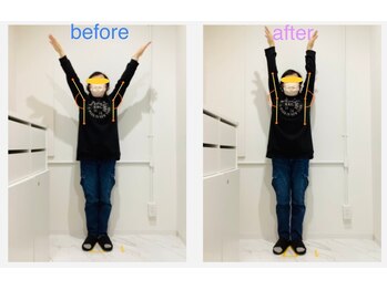 レピア 夙川本店(Lepia)/ビフォーアフターのご紹介♪