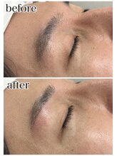 スリーズララ(Cerise LaLa)/お客様症例/眉毛WAX