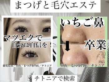 チトニア(CHITONIA)