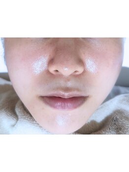 毛穴ケアをしたい