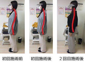 ストラボ 横浜店/ビフォーアフター９