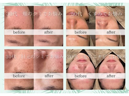 サロン リア(Salon Li’a)の写真