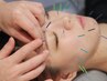 美容鍼★試したい、肌悩み少なめ、メンテナンスの方向けヘッド付60分¥9350→