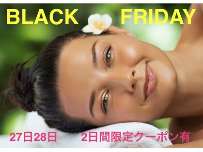 ロージースマイル(Rosy smile)の写真