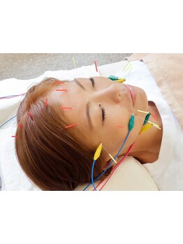 鍼灸施術を受けたい