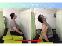 ケアるら整骨院 富里院/ビフォーアフター