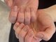 ビーミーネイル(be me Nail)の写真/お客様一人ひとりに寄り添いながら、丁寧なカウンセリングと施術を行います。