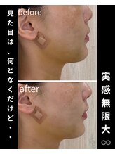 ダウンタイムオンニ(DowntimeOnni)/たった45分ですっきり！