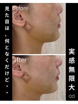 ダウンタイムオンニ(DowntimeOnni)/たった45分ですっきり！