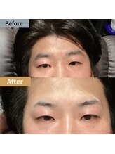 眉毛ハウス 吉祥寺店(眉毛HOUSE)/お客様の施術例(吉祥寺/東京)