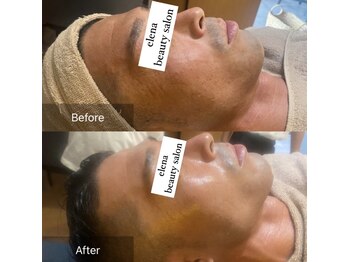 エレナ(Elena)/男性も美容の時代