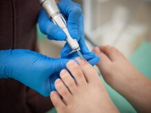 巻き爪補正店 那覇店/お爪の施術♪