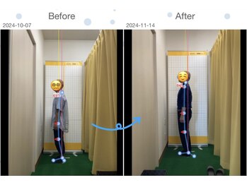 ひろがる接骨院 総社院/ビフォーアフター