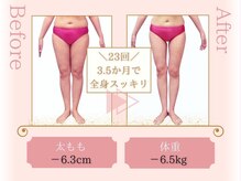 ピュアエステ ブリアント 松戸店/お客様の結果［松戸/痩身］