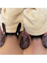 シェリー(Cherie)/うなじWAX+光脱毛