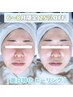 ＜６～８月限定★＞ホワイトスノーピール70分 12,000→9,000円＜美白特化！＞