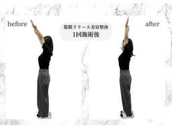 トキ(TOKI)/筋膜リリース美容整体 施術後