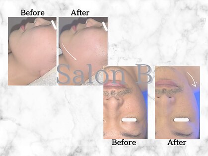 サロンビー 赤坂(SalonB)の写真