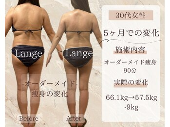 サロン ド ボーテ ラーンジュ 岐阜店(salon de beaut'e L'ange)/ハイパ-ナイフEX2ダイエット痩身