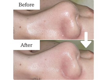 グラシア(gracia)/シミ・毛穴ケア専門店gracia