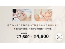 バニスター(Bannister)