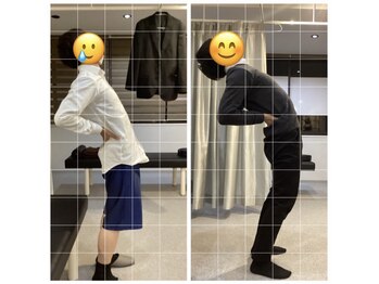 ナオル整体 三宮院(NAORU整体)/20代男性整体事例【後屈動時痛】