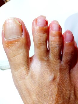 ソラ(sora)/巻いてるとこ、切ってませんか？