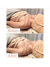 ハニー(Honey)/before★after