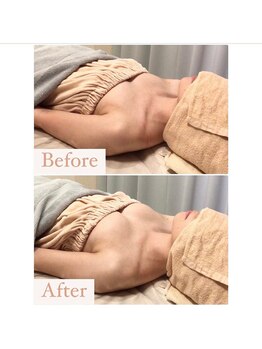 ハニー(Honey)/before★after