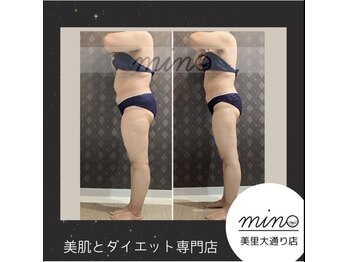 ミノ 美里大通り店(mino)/ダイエットパッケージ