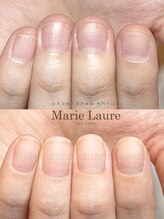 マリーロール 淀屋橋本店(Marie Laure)/自爪育成/深爪矯正/ネイルケア