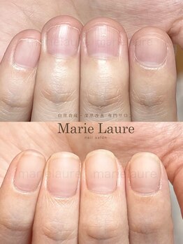マリーロール 淀屋橋本店(Marie Laure)/自爪育成/深爪矯正/ネイルケア