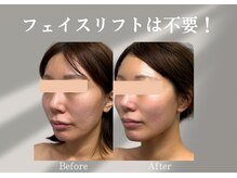 アールメディカルサロン 富山院(R Medical Salon)の雰囲気（スッキリ小顔！V字フェイスラインが叶う！たるみケア／小顔）